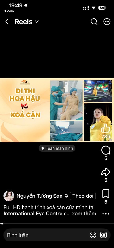 Reels Á hậu Nguyễn Tường San: đi thi hoa hậu vs xoá cận